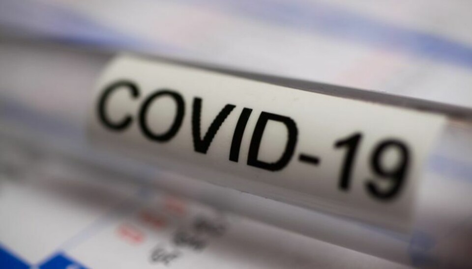 Nye testkriterier for covid-19
